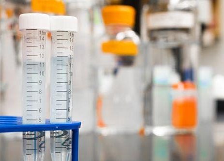Test tubes filled with liquid