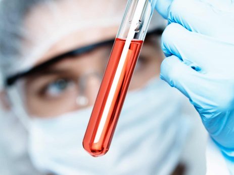 Scientist examining a test tube with an acidic solution with methyl orange indicator