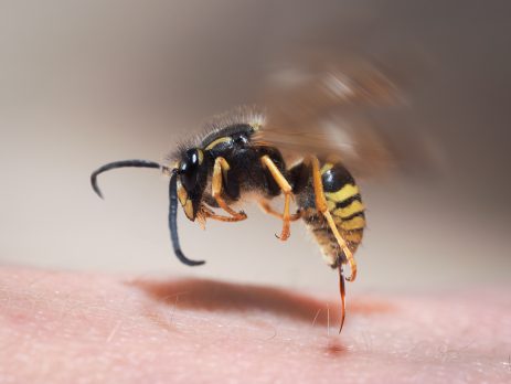 Wasp sting pulling out of human skin