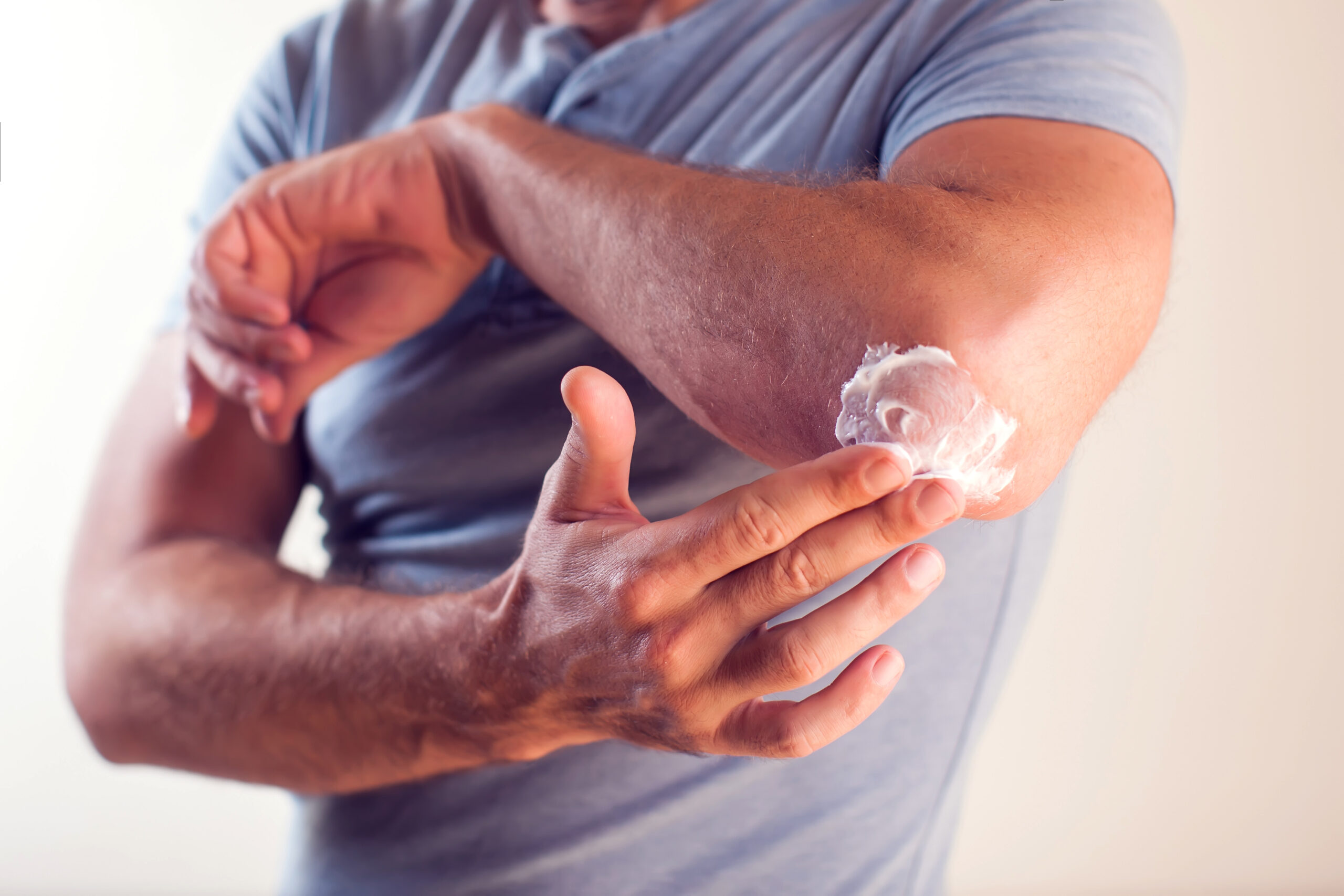 A man applying cream onto a dry elbow.