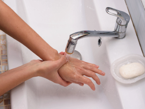 Person washing a burn on their hand under running water