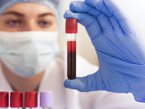 Scientist holding test tube of blood